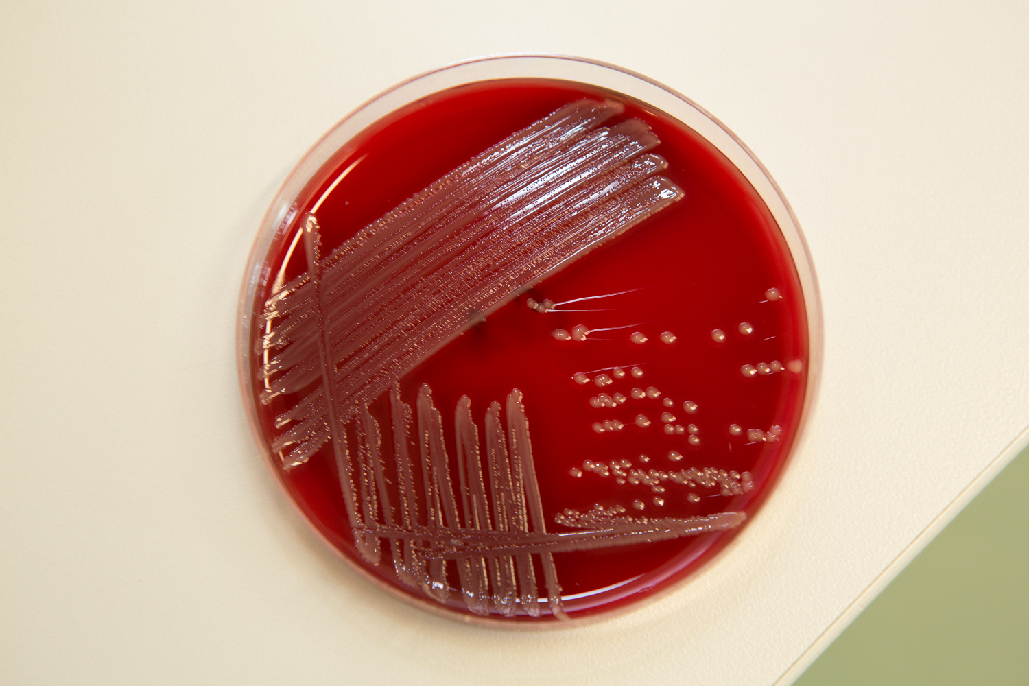 mavepine Sociologi Sig til side E. Coli – FerkeldurchfallF18